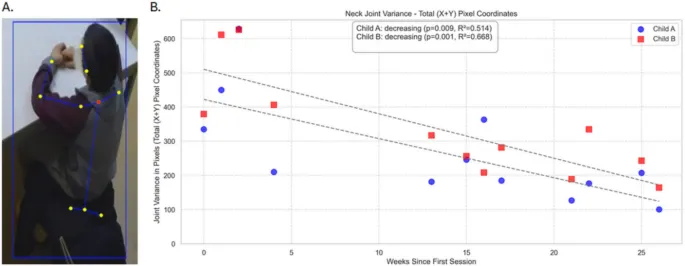 Рис. 7 Шейный сустав и его изменчивость с течением времени