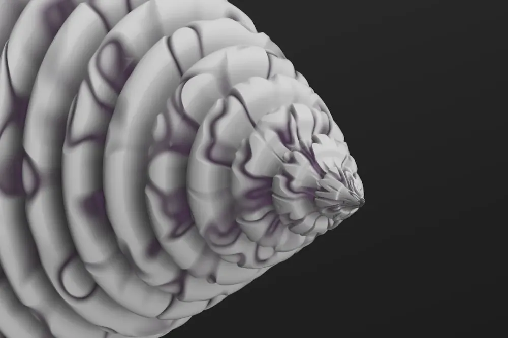 Исследование ЭЭГ в состоянии покоя: отсутствие надежных биомаркеров латерализации тиннитуса