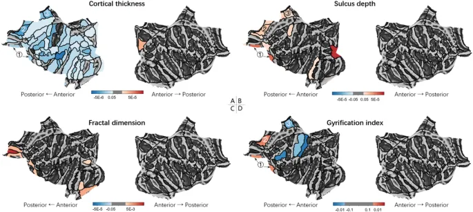 Рисунок 2: Анализ морфометрии в ключевых областях мозга