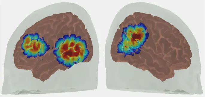 Рисунок 1: Схематическое изображение областей мозга, в которых проводились измерения фМРТ
