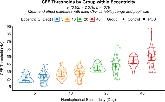 Рис. 7: Тенденция повышения пороговых значений КЧМ в периферии у лиц с ПКС.