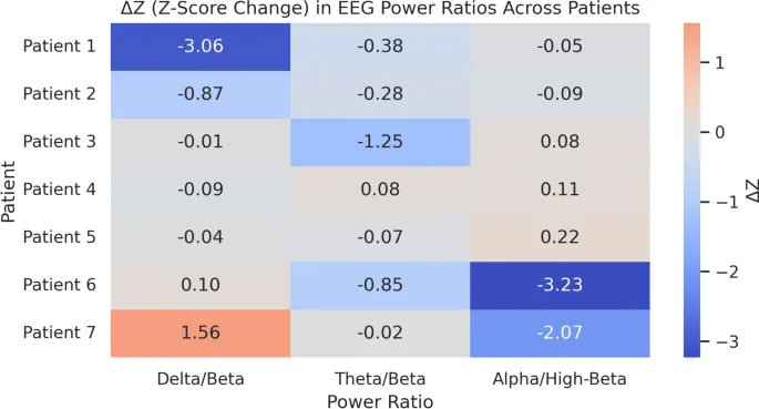 Рисунок 4: Тепловая карта ΔZ-оценок в соотношениях мощностей ЭЭГ (Дельта/Бета, Тета/Бета, Альфа/Высокая Бета) после NF-тренинга. Каждая строка представляет пациента; столбцы соответствуют соотношениям. Теплые цвета (красный) указывают на увеличенное отклонение от нормативного среднего (положительное ΔZ); прохладные цвета (синий) указывают на уменьшенное отклонение (отрицательное ΔZ). Значения |Z|≥ 2 обычно интерпретируются как клинически значимые в анализе qEEG