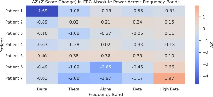 Рисунок 3: Тепловая карта ΔZ-оценок в абсолютной мощности ЭЭГ по частотным диапазонам после NF-тренинга. Каждая строка представляет пациента; столбцы соответствуют Дельта, Тета, Альфа, Бета и Высокая Бета. Теплые цвета (красный) указывают на увеличенное отклонение от нормативного среднего (положительное ΔZ); прохладные цвета (синий) указывают на уменьшенное отклонение (отрицательное ΔZ). Значения |Z|≥ 2 обычно интерпретируются как клинически значимые в анализе qEEG