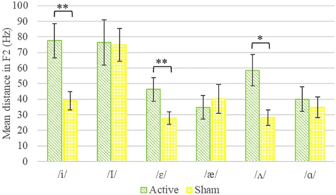 Схема расположения электродов tDCS.