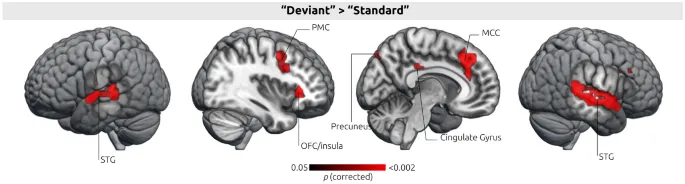 Фигура 2: Нейронные корреляты обнаружения статистических отклонений.
