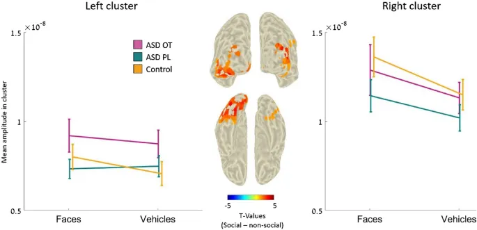Рисунок 5: Сравнение активации в левом и правом кластерах