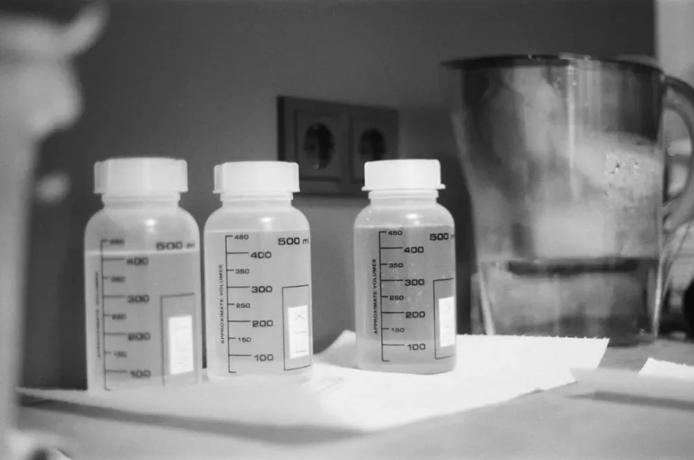 Профилактика диабета у беженцев с депрессией: эффективность программ с участием медицинских работников