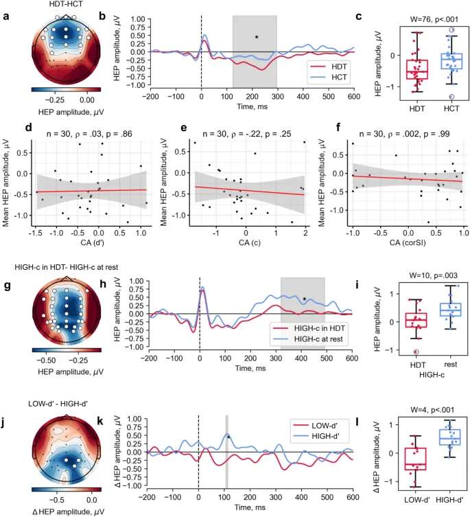 Рис. 4. Результаты сравнения амплитуд ВПС между условиями и группами: (a-c) разница между ЗРC и ЗПС; (g-i) разница между ЗРC и состоянием покоя для группы с высоким значением c; (j-l) модуляция ВПС между группами с низким и высоким значением d′ в ЗРC.