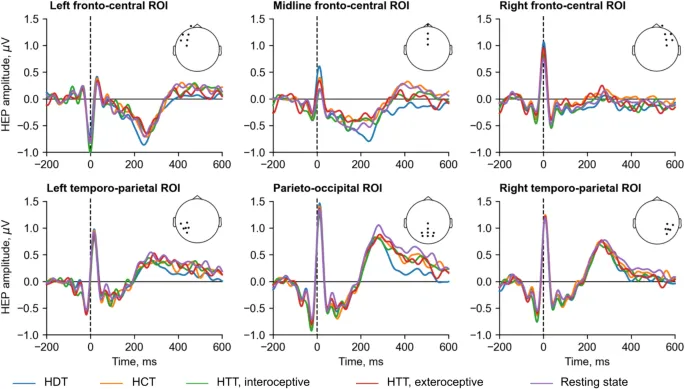 Рис. 3. Средние амплитуды ВПС в различных группах каналов во время ЗРC, ЗПС и состояния покоя.