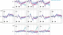 График негативности рассогласования при изменении интенсивности звука