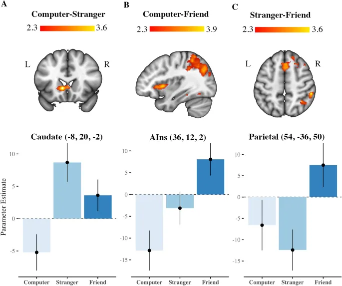 Рис. 4: Связь правой теменной коры с веретенообразной извилиной (FG) и нижней/средней височной извилиной.